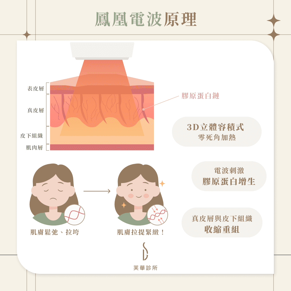鳳凰電波原理